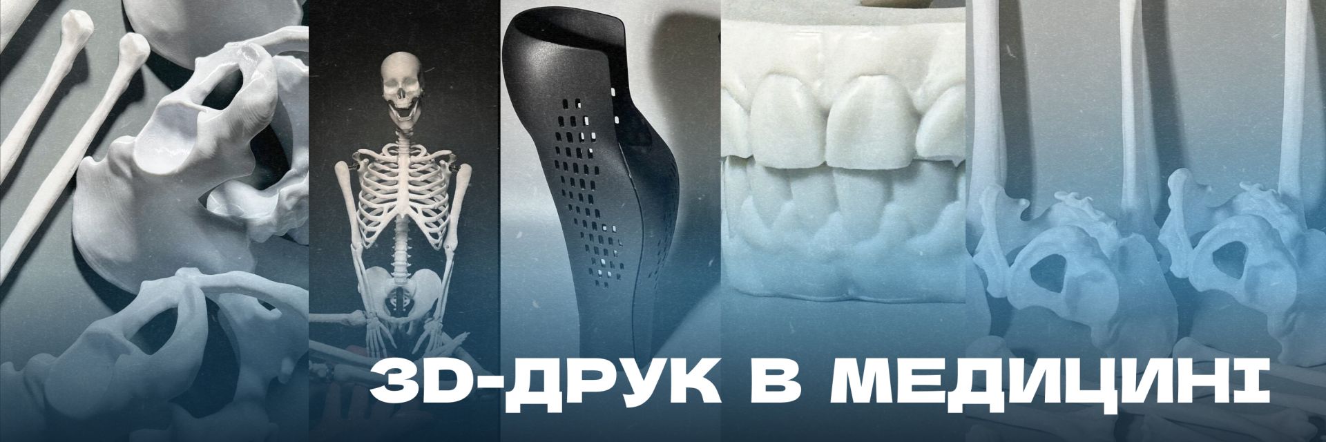 3D-друк в медицині